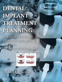 Cover image: Dental Implant Treatment Planning for New Dentists Starting Implant Therapy 9781546221111