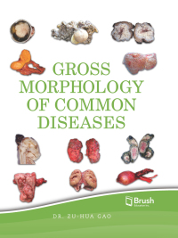 Cover image: Gross Morphology of Common Diseases 9781550596854