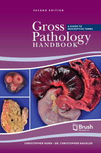 Cover image: Gross Pathology Handbook 2nd edition 9781550599114