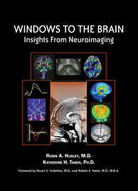Titelbild: Windows to the Brain 9781585623020