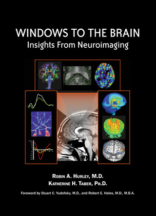 Cover image: Windows to the Brain 9781585623020