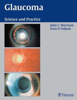 表紙画像: Glaucoma 1st edition 9780865779150