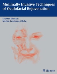 表紙画像: Minimally Invasive Techniques of Oculofacial Rejuvenation 1st edition 9781588902313