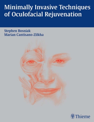 Cover image: Minimally Invasive Techniques of Oculofacial Rejuvenation 1st edition 9781588902313