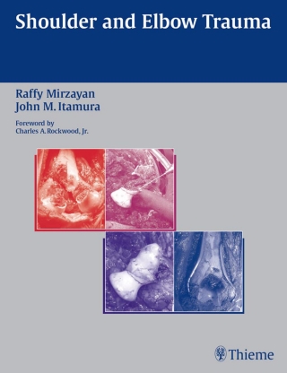 صورة الغلاف: Shoulder and Elbow Trauma 1st edition 9781588902191