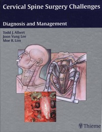 Cover image: Cervical Spine Surgery Challenges: Diagnosis and Management 1st edition 9781588904942