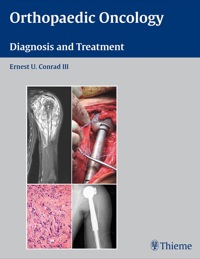 表紙画像: Orthopaedic Oncology 1st edition 9781588905239