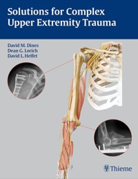 Titelbild: Solutions for Complex Upper Extremity Trauma 1st edition 9781588905048