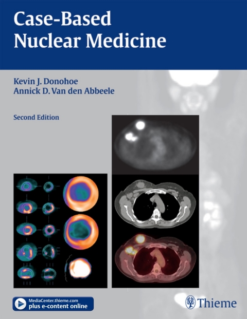 Case-Based Nuclear Medicine, 2nd  Edition - FULL INSTANT DOWNLOAD | PDF DOCX EPUB
