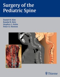 Cover image: Surgery of the Pediatric Spine 1st edition 9781588903426