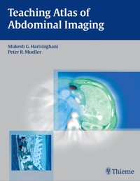 Imagen de portada: Teaching Atlas of Abdominal Imaging 1st edition 9781588906564