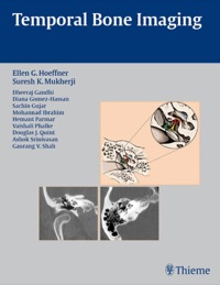 Omslagafbeelding: Temporal Bone Imaging 1st edition 9781588904010