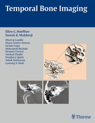 Imagen de portada: Temporal Bone Imaging 1st edition 9781588904010