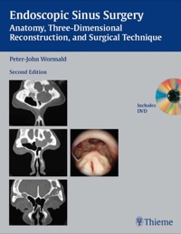 Cover image: Endoscopic Sinus Surgery: Anatomy, Three-Dimensional Reconstruction, and Surgical Technique 2nd edition 9781588906038