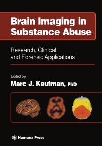 Imagen de portada: Brain Imaging in Substance Abuse 1st edition 9780896037700