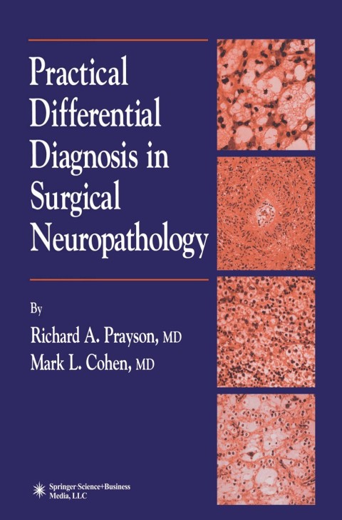 Practical Differential Diagnosis in Surgical Neuropathology - FULL INSTANT DOWNLOAD | PDF DOCX EPUB