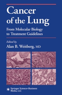 Cover image: Cancer of the Lung 1st edition 9780896038301
