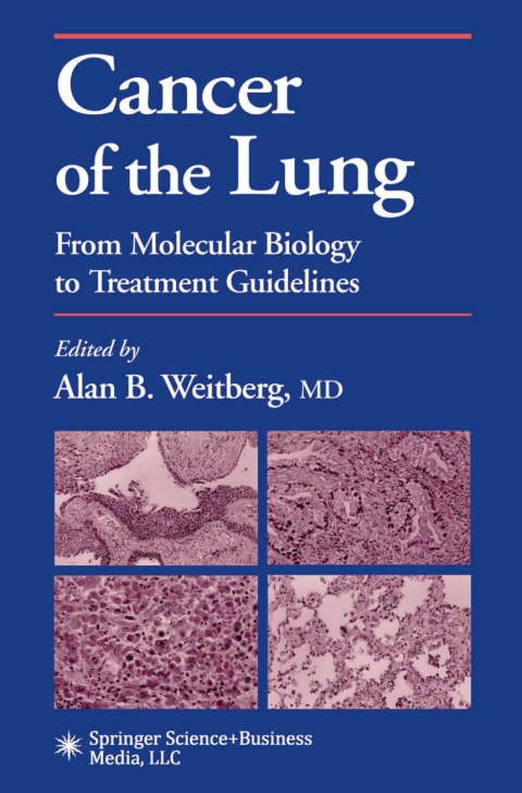 Cancer of the Lung: From Molecular Biology to Treatment Guidelines, 1st Edition - FULL INSTANT DOWNLOAD | PDF DOCX EPUB