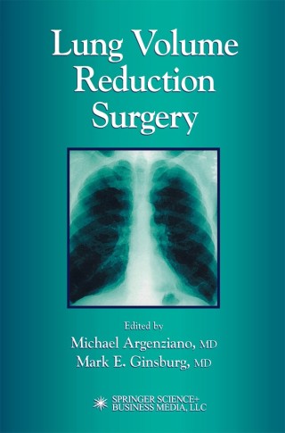 Cover image: Lung Volume Reduction Surgery 1st edition 9781592591213