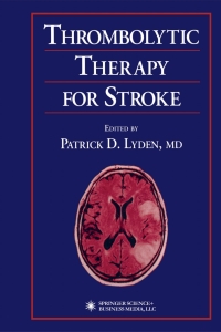 Omslagafbeelding: Thrombolytic Therapy for Stroke 1st edition 9780896037465