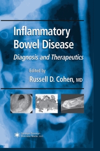 表紙画像: Inflammatory Bowel Disease 1st edition 9780896039094