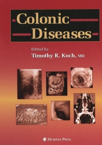 Imagen de portada: Colonic Diseases 1st edition 9780896039612