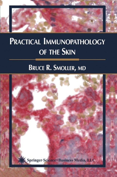 Practical Immunopathology of the Skin - FULL INSTANT DOWNLOAD | PDF DOCX EPUB