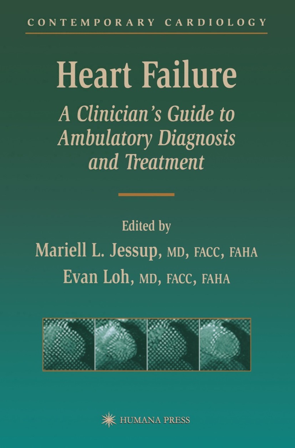 Heart Failure A Clinician’s Guide to Ambulatory Diagnosis and Treatment 1st Edition