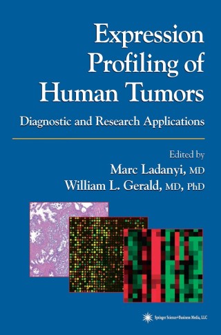 Immagine di copertina: Expression Profiling of Human Tumors 1st edition 9781588291226