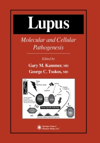 Cover image: Lupus 1st edition 9781592597031