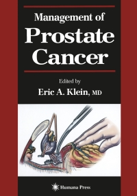 Imagen de portada: Management of Prostate Cancer 1st edition 9781592597147