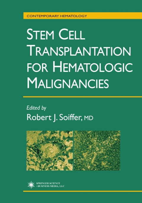 Stem Cell Transplantation for Hematologic Malignancies, 1st Edition - FULL INSTANT DOWNLOAD | PDF DOCX EPUB