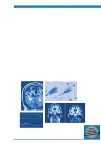 Cover image: Atypical Parkinsonian Disorders 1st edition 9781588293312