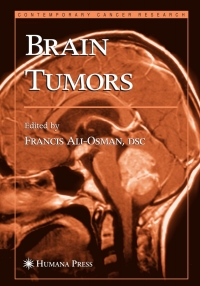 Cover image: Brain Tumors 1st edition 9781588290427