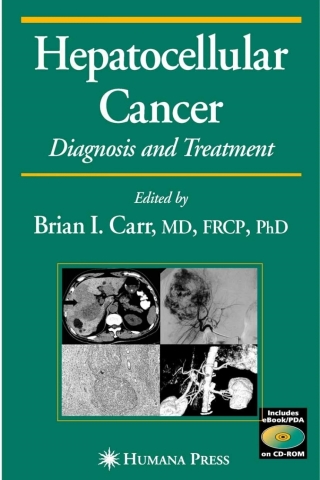 Imagen de portada: Hepatocellular Carcinoma 9781588291257