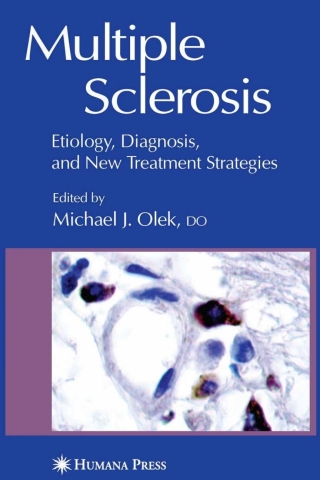表紙画像: Multiple Sclerosis 1st edition 9781588290335