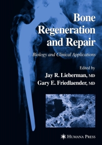 Imagen de portada: Bone Regeneration and Repair 1st edition 9780896038479