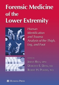 Titelbild: Forensic Medicine of the Lower Extremity 1st edition 9781588292698