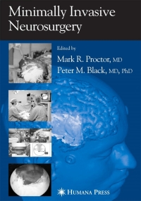 صورة الغلاف: Minimally Invasive Neurosurgery 1st edition 9781588291479