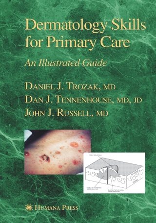 Cover image: Dermatology Skills for Primary Care 9781588294890