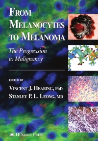 Imagen de portada: From Melanocytes to Melanoma 1st edition 9781588294593