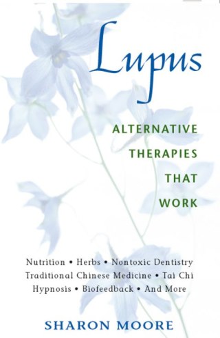 Cover image: Lupus 9780892818891