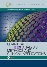 Cover image: Quantitative EEG Analysis Methods and Applications 9781596932043