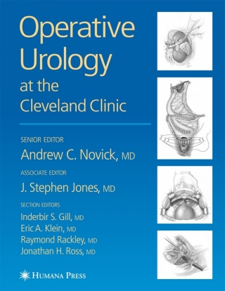 Imagen de portada: Operative Urology 1st edition 9781588290816