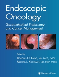 Cover image: Endoscopic Oncology 1st edition 9781588295323