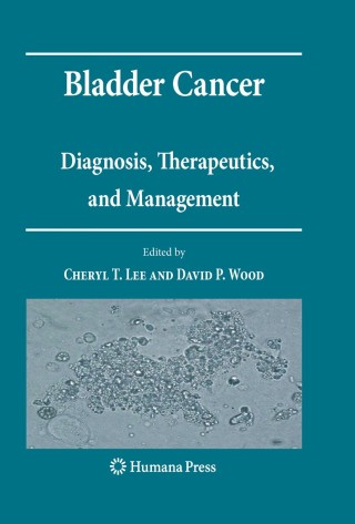 Cover image: Bladder Cancer 1st edition 9781588299888