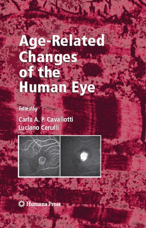 Age-Related Changes of the Human Eye, 1st Edition - FULL INSTANT DOWNLOAD | PDF DOCX EPUB