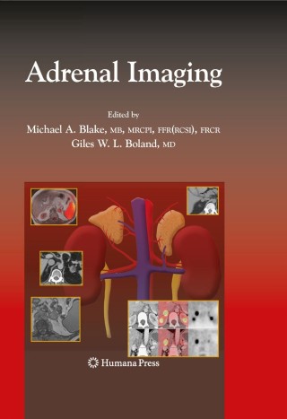 Imagen de portada: Adrenal Imaging 1st edition 9781934115862