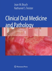 表紙画像: Clinical Oral Medicine and Pathology 9781603275194