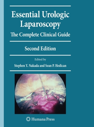 صورة الغلاف: Essential Urologic Laparoscopy 2nd edition 9781603278195